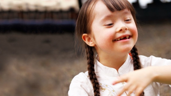 down syndrome hero banner stanford childrens 720x315